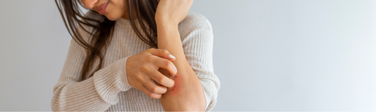 Lessive et eczéma : comment protéger les peaux sensibles au quotidien ?